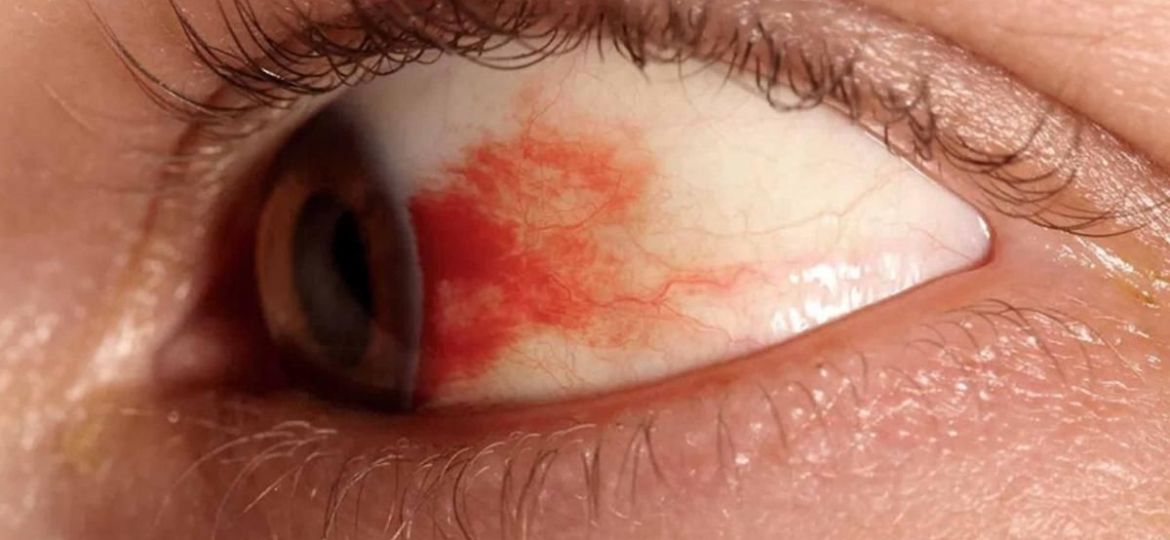 UNAM-desarrolla-gotas-oftalmicas-basadas-en-la-vasoinhibina-para-tratar-la-retinopatia-diabetica