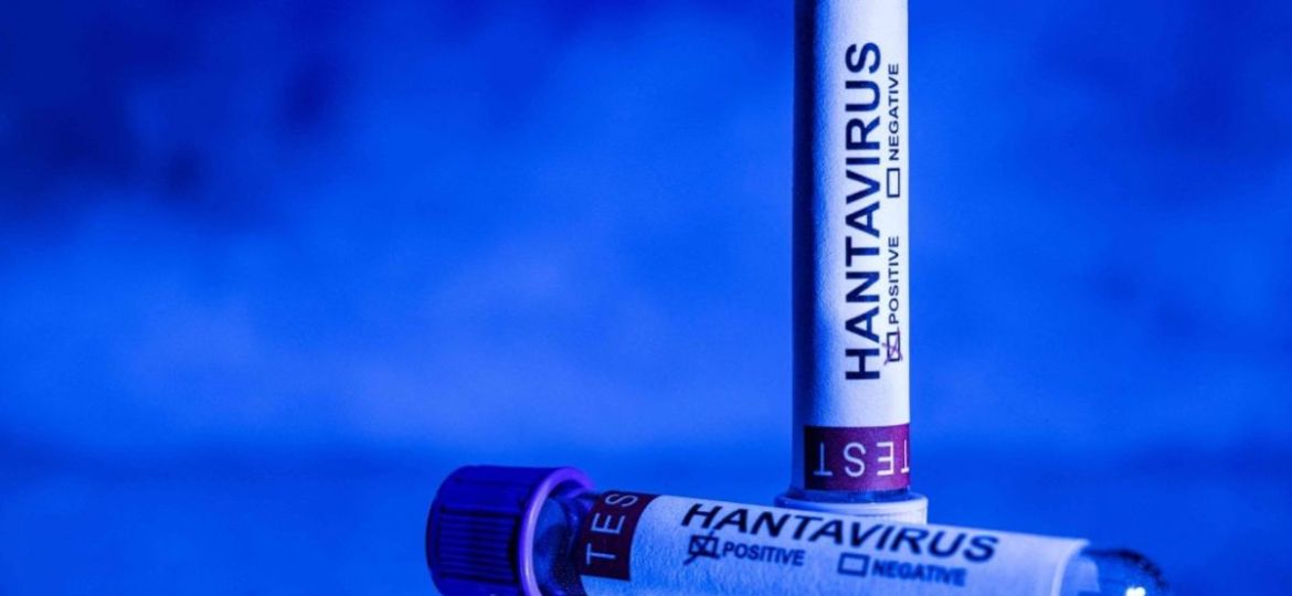 Nuevo-positivo-de-hantavirus-en-Espana-pasajero-evacuado-del-crucero-Hondius-ingresado-en-el-Gomez-Ulla