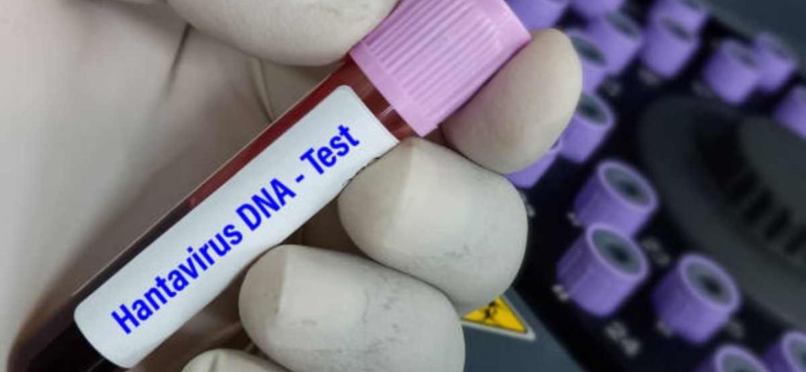 Que-es-el-hantavirus-y-como-se-transmite-claves-tras-el-brote-en-el-crucero-MV-Hondius