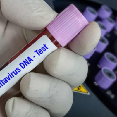Que-es-el-hantavirus-y-como-se-transmite-claves-tras-el-brote-en-el-crucero-MV-Hondius